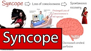 Syncope and Fainting Syncope Types and Treatment Simply explained [upl. by Inva984]