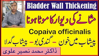 Bladder Wall Thickeningمثانے کی دیوار کا موٹا ہونا۔مثانے کی سوزش ۔ Copaiva officinalis [upl. by Ahsilram365]