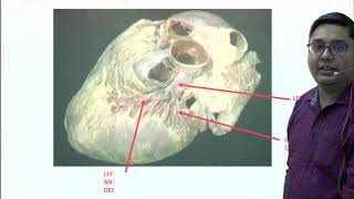 IDoR2018 Cardiac Basics of Coronary Anatomy [upl. by Mellman]