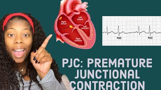 Basic EKG Identifying premature junctional contractions PJCS [upl. by Mavis]