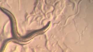 C Elegans Pharynx movement when eating [upl. by Razaele]