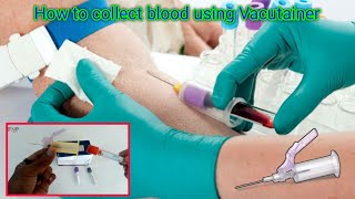 How to collect blood using Vacutainer  Vacutainer Blood Collection Procedure  Blood Test Procedure [upl. by Galloway]