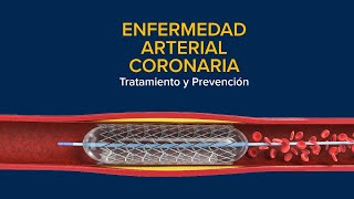 Enfermedad Arterial Coronaria EAC Tratamiento y prevención [upl. by Uyr126]