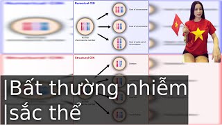 Nguyên Nhân Gây Ra Bất Thường Nhiễm Sắc Thể [upl. by Rolecnahc]