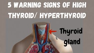 Warning signs of hyperthyroid symptoms of high thyroid thyroid ke lakshan thyroid [upl. by Salem866]