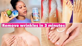 How to Remove Wrinkles amp Fine Lines from Hands amp Foots in 3 minutes 😱 [upl. by Matta286]