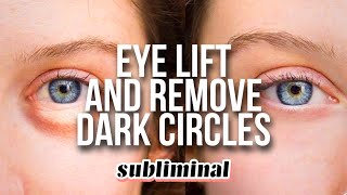 GET RID OF DARK CIRCLES  EYE BAGS EYE LIFT EYEBROW LIFT SUBLIMINAL [upl. by Ylloj503]