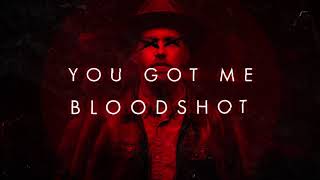 Sam Tinnesz  Bloodshot Official Lyric Video [upl. by Lac238]