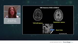 CMSC 2020 Day 2 Brenda Banwell MD on Current Perspectives of Pediatric MS Care and Research [upl. by Yr]