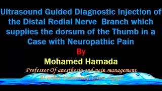 ultrasound Guided Diagnostic Injection to the Distal Radial Nerve Branch [upl. by Joan288]