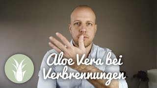 Aloe Vera Gel bei Verbrennungen  Brandwunden  Brandverletzungen  als BIODALOE bei MIVITA [upl. by Marleah986]