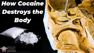 Why Cocaine Is So Incredibly Dangerous [upl. by Lamahj]