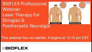 Laser Therapy For Shingles amp Postherpetic Neuralgia [upl. by Nedearb]