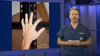 Jimmy Fallon Finger Injury Ring Avulsion [upl. by Hserus]