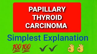 Papillary Thyroid Carcinoma [upl. by Ademordna]