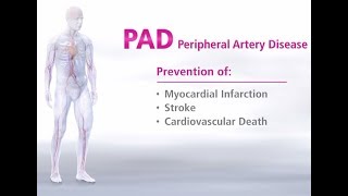 What is Peripheral Artery Disease  Mechanism of Disease [upl. by Dallman]