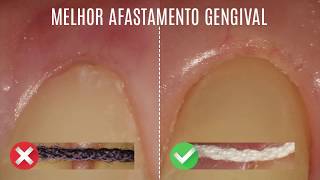 fio retrator qual o melhor Veja como escolher fios retratores [upl. by Borlow]