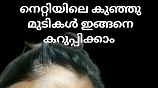 ചെറിയ മുടികൾ കറുപ്പിക്കാൻ [upl. by Aihsakal]