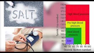 Stroke Controllable and Uncontrollable Risk Factors [upl. by Irac]