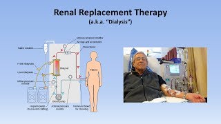 Acute Kidney Injury Part 33  Treatment and Complications [upl. by Auqemahs314]