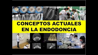 quotCONCEPTOS ACTUALES EN LA ENDODONCIAquot [upl. by Nah]