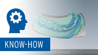 Abdruck Scan Tutorial mit Ceramill Map Scanner [upl. by Ytok]