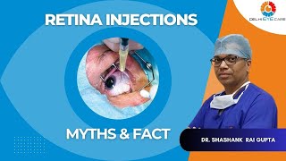 Eye Injections  Myths amp Facts  Dr Shashank Rai Gupta  Delhi Eye Care [upl. by Ludie743]