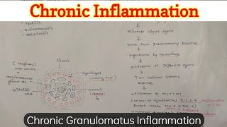 Chronic Granulomatus Inflammation [upl. by Anomer724]