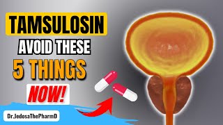 Taking Tamsulosin 5 Things You Must Avoid If You Are Taking Tamsulosin [upl. by Darra]