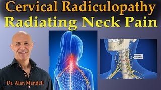 Cervical Radiculopathy Radiating Neck Pain  Dr Mandell Live Stream [upl. by Brieta]