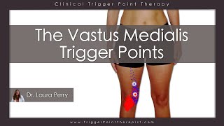 The Vastus Medialis Trigger Points [upl. by Aesoh617]