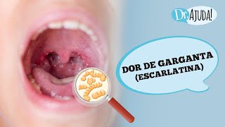 DOR DE GARGANTA E ESCARLATINA QUANDO SUSPEITAR  DIAGNÓSTICO TRATAMENTO E COMO PREVENIR [upl. by Janenna]