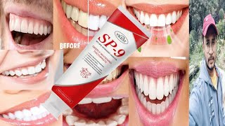 Sp9 Toothpaste  Honest Review [upl. by Ostap257]