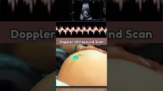 Doppler ultrasound pregnancy viral baby youtubeshorts [upl. by Lindie713]