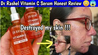 Dr Rashel Vitamin C Serum Review UNSPONSORED UNPAID video [upl. by Moyra759]