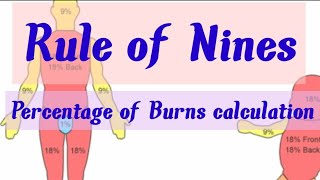 Rule of Nine Burns formulaBurns calculation Percentage of Burns [upl. by Ellora]