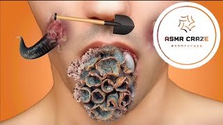 ASMR Maggot Removal Deep Lip Cleaning Animation  asmr [upl. by Amitak232]