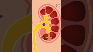 What Causes Kidney Stones  World Kidney Day Special shorts kidneystone worldkidneyday [upl. by Sonaj]