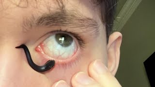 este insecto está atascada en mi OJO 😨 [upl. by Susumu]