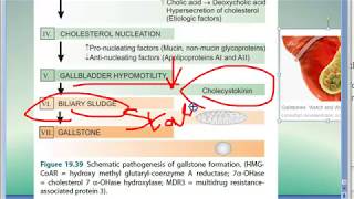 Pathology 641 c Pathogenesis of GallStones Cholelithiasis Gall Bladder Stones Cholecystokinin [upl. by Esinereb]