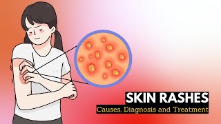 Skin Rash Causes Signs and Symptoms Diagnosis and Treatment [upl. by Ailegra]