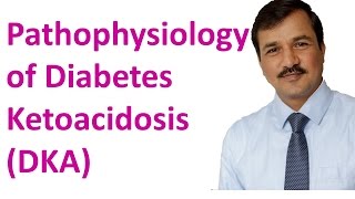 Diabetes Ketoacidosis DKA  Pathophysiology [upl. by Arukas]