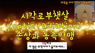 시각로부챗살optic radiation  반대쪽 동측 반맹contralateral homonymous hemianopsia Meyers loop [upl. by Panthia645]