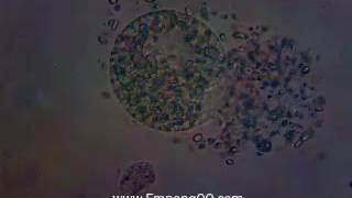 Fresh Water Oodinium cysts crack [upl. by Roswald633]