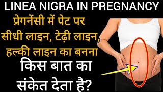 Black Line on Belly During Pregnancy Linea Nigra  Boy or Girl Pregnancy Signs Baby Boy Symptoms [upl. by Arihaz]