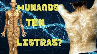 Curiosidade do Corpo Humano Humanos tem listras  Eterna Busca [upl. by Crystal488]