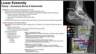 Ankle Posterior Impingement Os Trigonum Syndrome EXPLAINED [upl. by Wobniar]