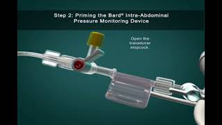 IntraAbdominal Pressure Monitoring [upl. by Eneloj884]