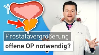 Prostatavergrößerung Prostata zu groß für minimalinvasive OP [upl. by Cirederf]