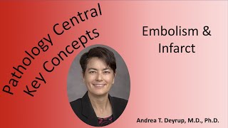 Medical School Pathology Pathophysiology amp Morphology of Embolism amp Infarct [upl. by Atteroc]